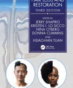 Hair Loss and Restoration eBook