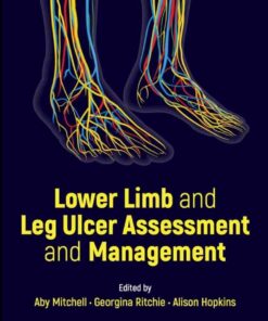 Lower Limb and Leg Ulcer Assessment and Management eBook