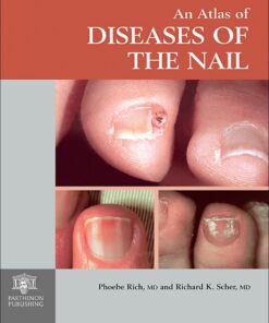 An Atlas of Diseases of the Nail eBook