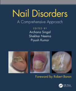 Nail Disorders: A Comprehensive Approach eBook