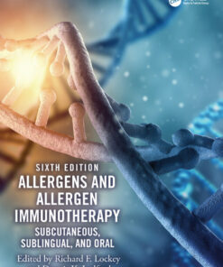 Allergens and Allergen Immunotherapy: Subcutaneous, Sublingual, and Oral eBook