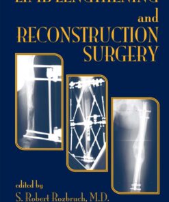 Limb Lengthening and Reconstruction Surgery eBook