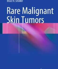 Rare Malignant Skin Tumors eBook