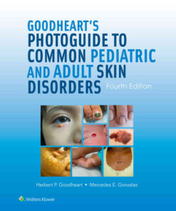 Goodheart's Photoguide to Common Pediatric and Adult Skin Disorders eBook