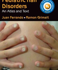 Pediatric Hair Disorders: Atlas and Text, T  eBook