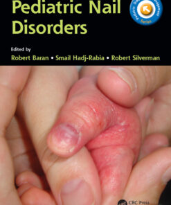Pediatric Nail Disorders eBook