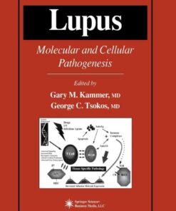 Lupus: Molecular and Cellular Pathogenesis eBook