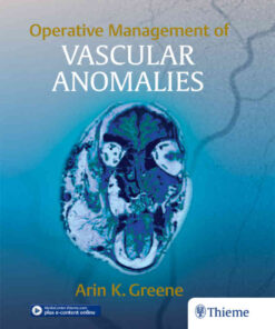 Operative Management of Vascular Anomalies eBook