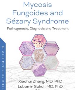 Mycosis Fungoides: Causes, Diagnosis and Treatment eBook