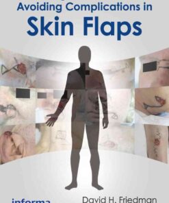 Making Decisions and Avoiding Complications in Skin Flaps eBook