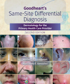 Goodheart's Same-Site Differential Diagnosis: Dermatology for the Primary Health Care Provider eBook