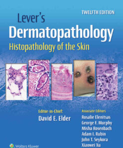 Lever's Dermatopathology Histopathology of the Skin eBook