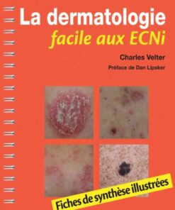 La dermatologie facile aux ECNi: Fiches de synthèse illustrées eBook