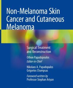 Non-Melanoma Skin Cancer and Cutaneous Melanoma: Surgical Treatment and Reconstruction eBook