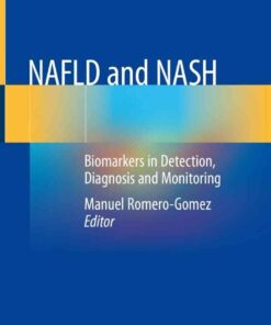 NAFLD and NASH: Biomarkers in Detection, Diagnosis and Monitoring eBook