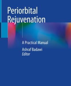 Periorbital Rejuvenation: A Practical Manual eBook
