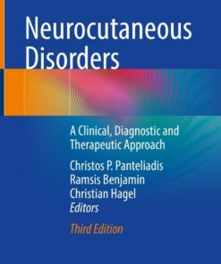 Neurocutaneous Disorders: A Clinical, Diagnostic and Therapeutic Approach eBook