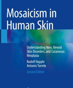 Mosaicism in Human Skin: Understanding Nevi, Nevoid Skin Disorders, and Cutaneous Neoplasia eBook