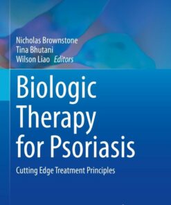 Biologic Therapy for Psoriasis: Cutting Edge Treatment Principles eBook