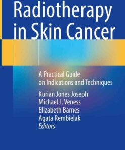 Radiotherapy in Skin Cancer: A Practical Guide on Indications and Techniques eBook