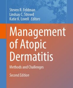 Management of Atopic Dermatitis: Methods and Challenges eBook