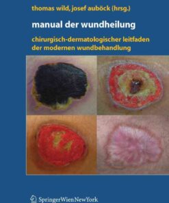 Manual der Wundheilung: Chirurgisch-dermatologischer Leitfaden der modernen Wundbehandlung eBook