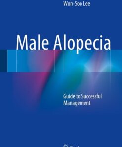 Male Alopecia: Guide to Successful Management eBook