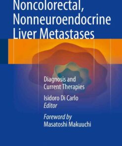 Noncolorectal, Nonneuroendocrine Liver Metastases: Diagnosis and Current Therapies eBook