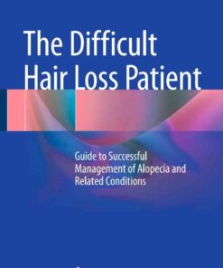 The Difficult Hair Loss Patient Guide to Successful Management of Alopecia and Rel eBook