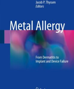 Metal Allergy: From Dermatitis to Implant and Device Failure eBook