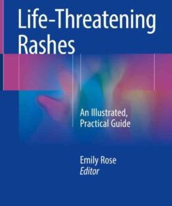 Life-Threatening Rashes: An Illustrated, Practical Guide eBook