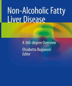 Non-Alcoholic Fatty Liver Disease: A 360-degree Overview eBook