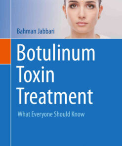 Botulinum Toxin Treatment: What Everyone Should Know eBook