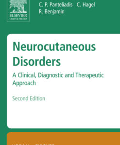Neurocutaneous Disorders: A Clinical, Diagnostic and Therapeutic Approach eBook