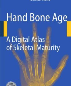 Hand Bone Age: A Digital Atlas of Skeletal Maturity eBook