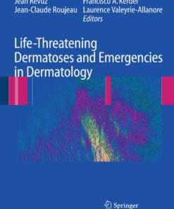 Life-Threatening Dermatoses and Emergencies in Dermatology eBook