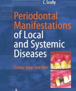 Periodontal Manifestations of Local and Systemic Diseases: Colour Atlas and Text eBook