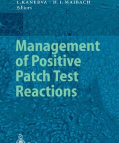 Management of Positive Patch Test Reactions eBook