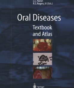 Oral Diseases: Textbook and Atlas eBook