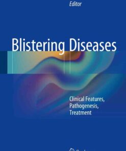 Blistering Diseases: Clinical Features, Pathogenesis, Treatment eBook