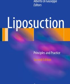 Liposuction: Principles and Practice eBook