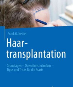 Haartransplantation: Grundlagen – Operationstechniken – Tipps und Tricks für die Praxis eBook