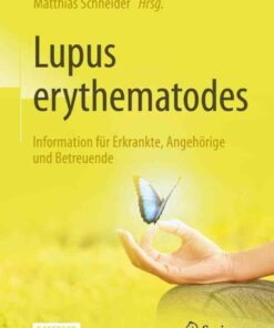 Lupus erythematodes: Information für Erkrankte, Angehörige und Betreuende eBook