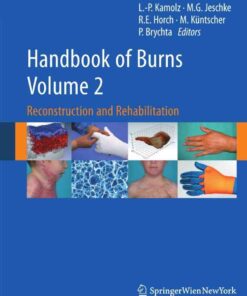 Handbook of Burns Volume 2: Reconstruction and Rehabilitation eBook