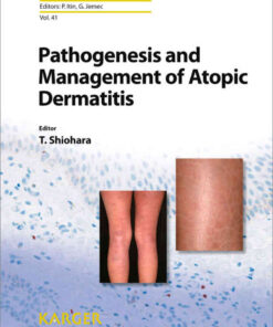 Pathogenesis and Management of Atopic Dermatitis eBook