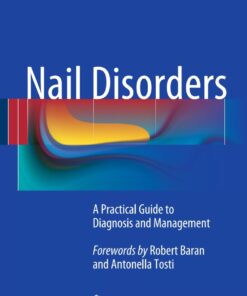 Nail Disorders: A Practical Guide to Diagnosis and Management eBook