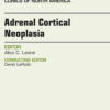 Adrenal Cortical Neoplasia, An Issue of Endocrinology and Metabolism Clinics of North America eBook