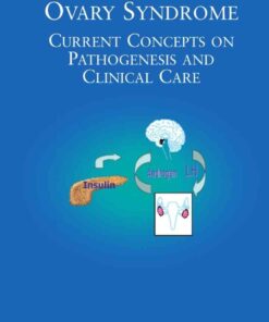 The Polycystic Ovary Syndrome: Current Concepts on Pathogenesis and Clinical Care eBook