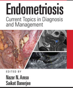 Endometriosis: Current Topics in Diagnosis and Management eBook