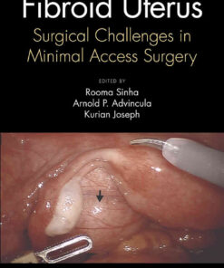 Fibroid Uterus: Surgical Challenges in Minimal Access Surgery eBook